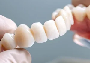 Dental Crowns