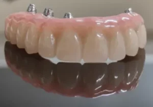 PROSTHODONTICS